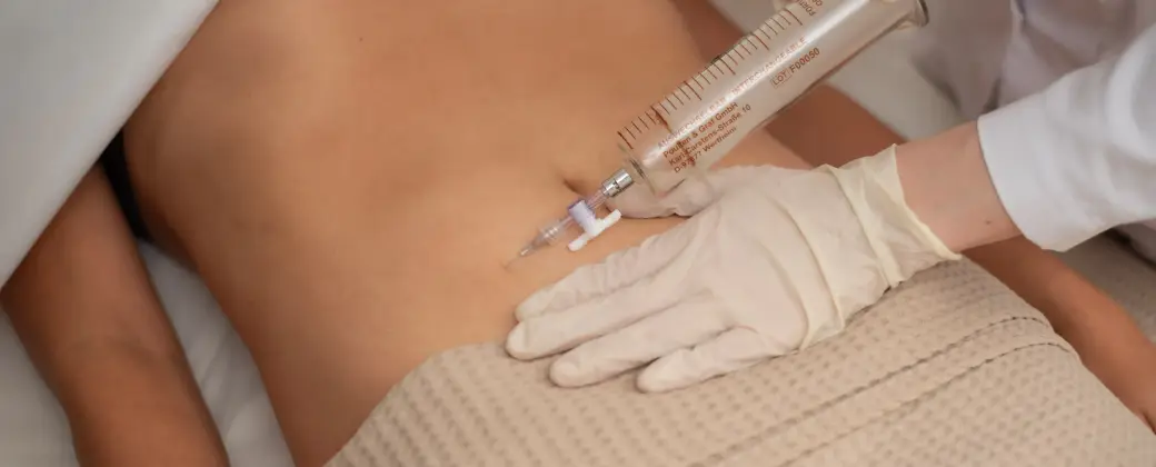 Озонотерапия в клинике Divus