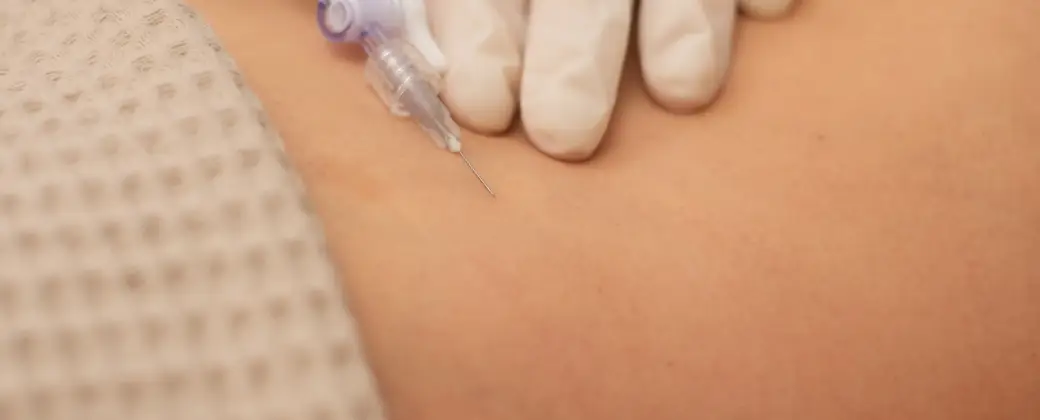 Инъекции озона в медцентре Divus